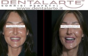 odontoiatria estetica