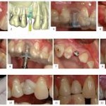 casa implantologia dentale