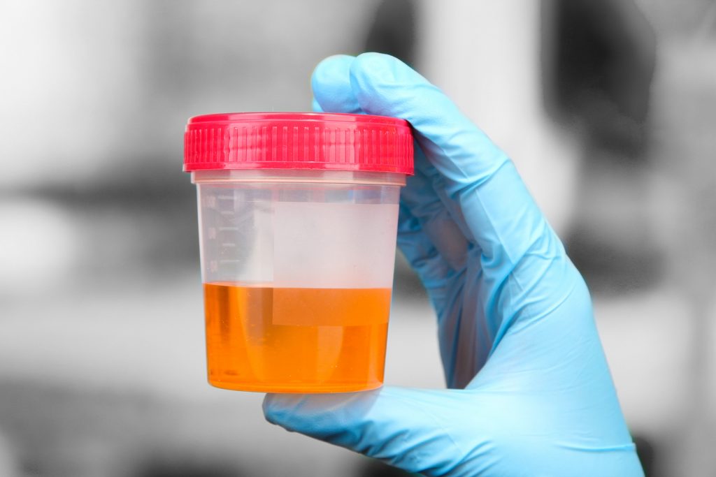 Il test delle urine arriva da Londra e ti dirà come mangi