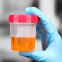 Il test delle urine arriva da Londra e ti dirà come mangi